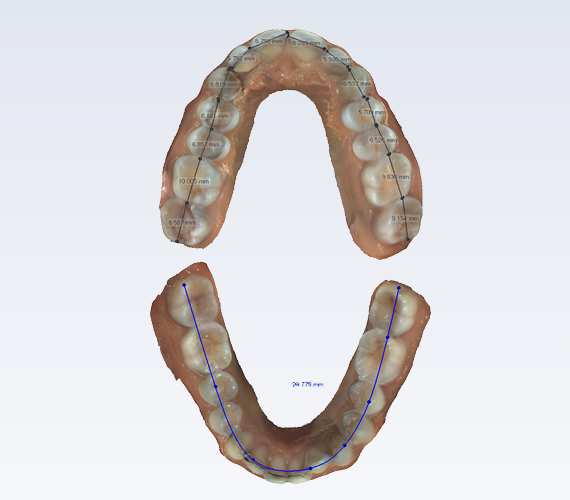 普兰梅卡 Planmeca Romexis 模块分析样本