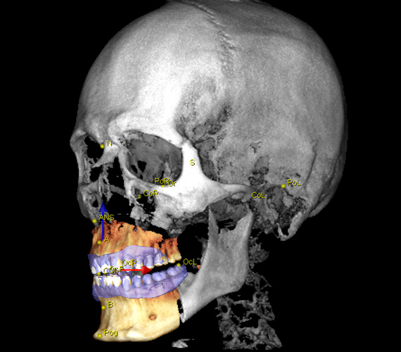 普兰梅卡 Planmeca Romexis Surgery 外科移动视图