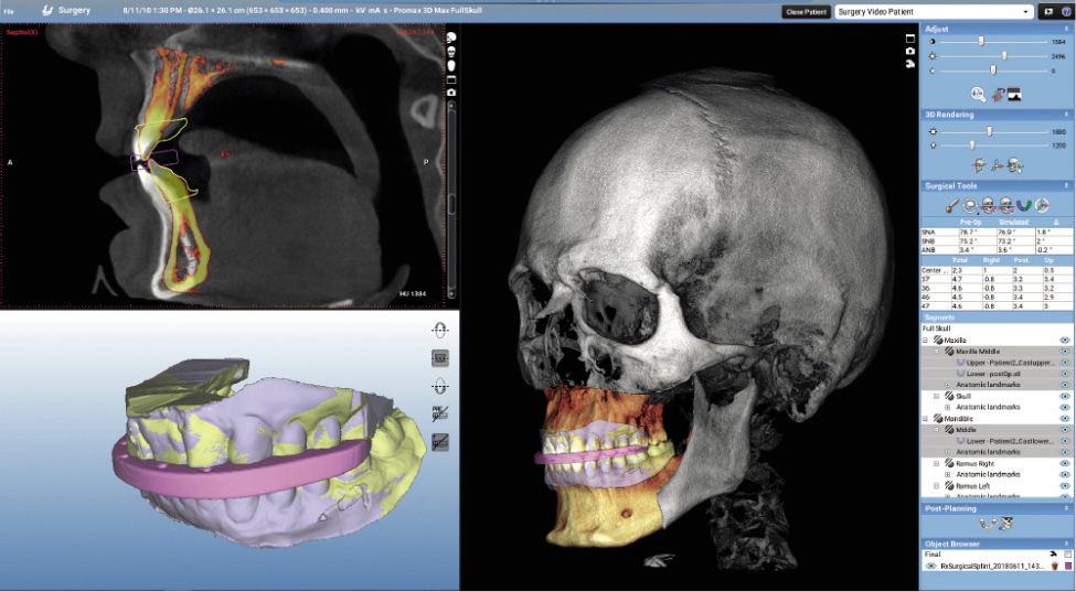 Planmeca Romexis Surgery