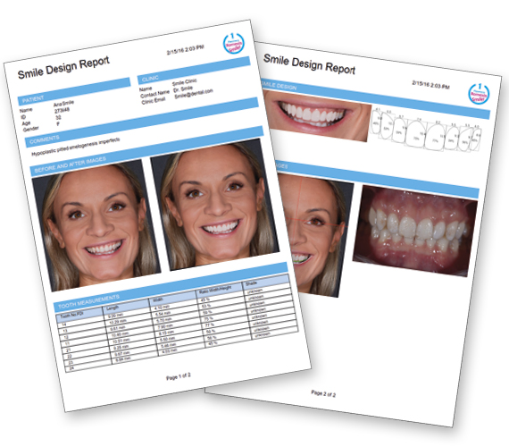 普兰梅卡 Planmeca Smile Design 微笑设计 DSD 报告