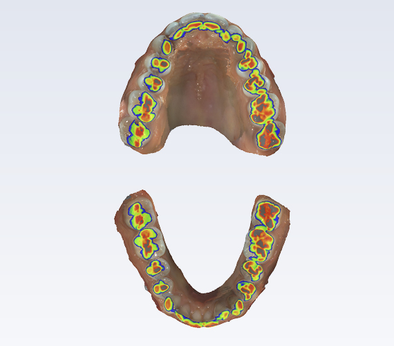 普兰梅卡 Planmeca Romexis 模块分析