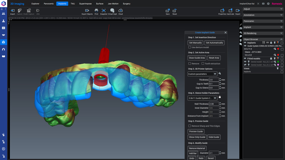 普兰梅卡 Planmeca Romexis 3D 种植计划