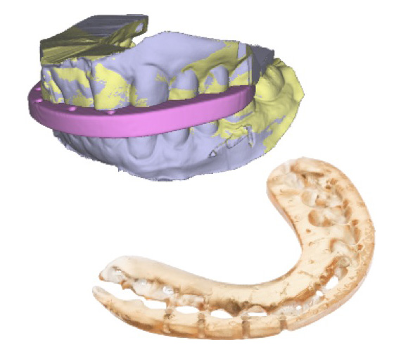 普兰梅卡 Planmeca Romexis Surgery 咬合垫