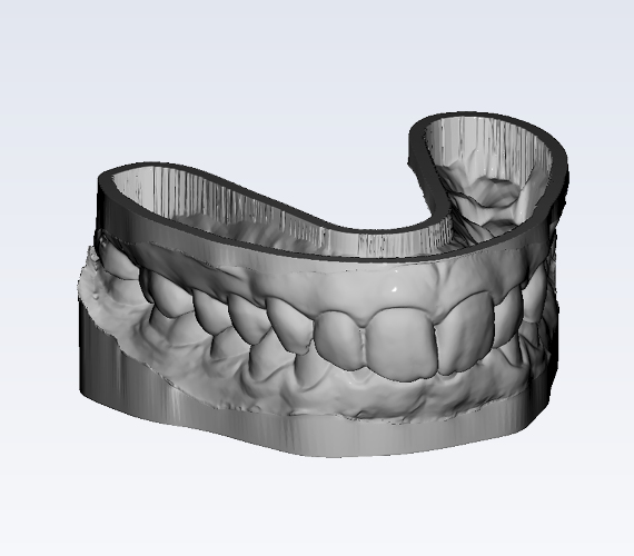 普兰梅卡 Planmeca Romexis Model Analyser 模块分析 3D 牙齿模型