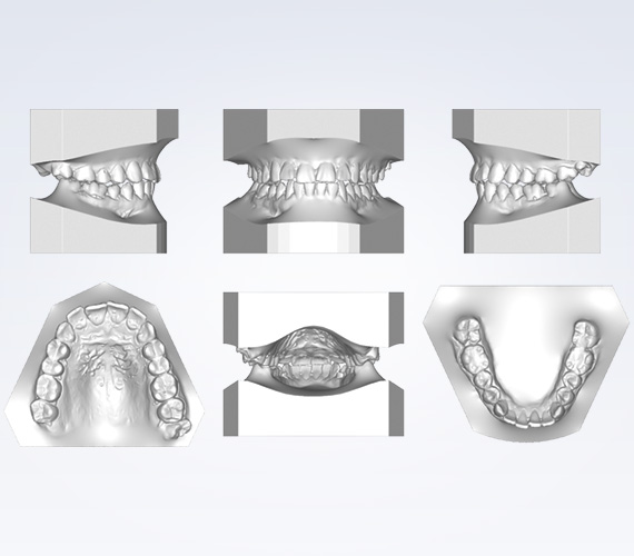 普兰梅卡 Planmeca Romexis Ortho Studio 正畸虚拟准备