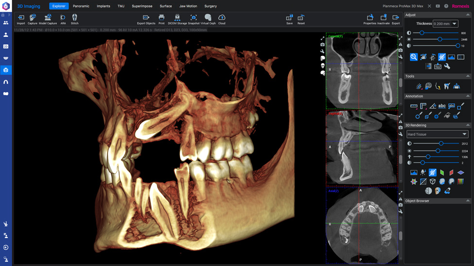 普兰梅卡 Planmeca Romexis 3D 口腔模块