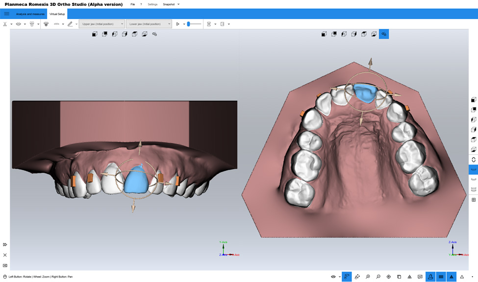 普兰梅卡 Planmeca Romexis Ortho Studio 正畸软件模块