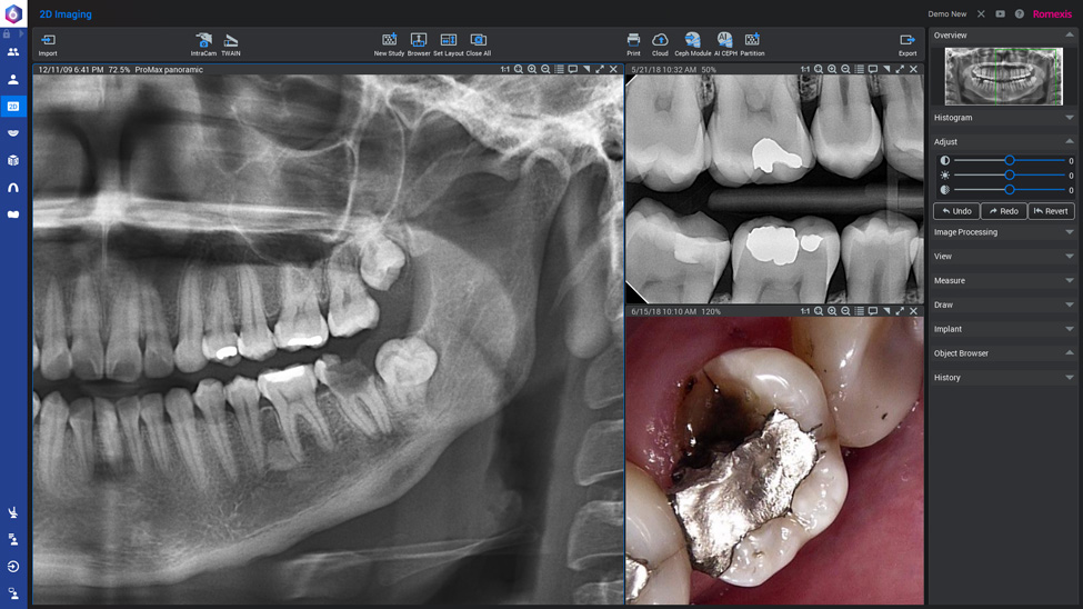 普兰梅卡 Planmeca Romexis 2D 牙科软件