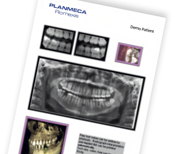 普兰梅卡 Planmeca Romexis 2D 成像报告